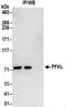 Phosphofructokinase, Liver Type antibody, NBP2-32213, Novus Biologicals, Immunoprecipitation image 