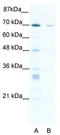 Zinc Finger Protein 37A antibody, TA334003, Origene, Western Blot image 