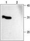 Synaptosome Associated Protein 25 antibody, TA328889, Origene, Western Blot image 
