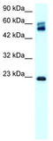 Claudin 8 antibody, TA334199, Origene, Western Blot image 