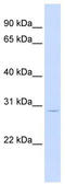 LIF Interleukin 6 Family Cytokine antibody, TA335060, Origene, Western Blot image 