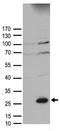 Suppressor Of Cytokine Signaling 1 antibody, TA890038, Origene, Western Blot image 