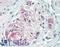 Chondroitin Sulfate Proteoglycan 4 antibody, LS-B14991, Lifespan Biosciences, Immunohistochemistry paraffin image 