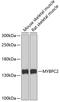 Myosin Binding Protein C, Fast Type antibody, GTX33336, GeneTex, Western Blot image 