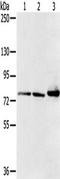 Calpain 7 antibody, TA349263, Origene, Western Blot image 