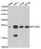 PYD And CARD Domain Containing antibody, A1170, ABclonal Technology, Western Blot image 