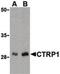 C1q And TNF Related 1 antibody, LS-B463, Lifespan Biosciences, Western Blot image 