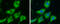 FAS antibody, GTX109833, GeneTex, Immunocytochemistry image 