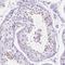 Sperm Acrosome Associated 5B antibody, HPA047149, Atlas Antibodies, Immunohistochemistry paraffin image 