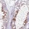 NBPF Member 12 antibody, HPA046971, Atlas Antibodies, Immunohistochemistry frozen image 