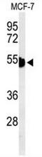 Keratin 1 antibody, AP52410PU-N, Origene, Western Blot image 