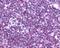 C-C Motif Chemokine Receptor 9 antibody, NLS961, Novus Biologicals, Immunohistochemistry paraffin image 