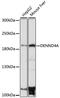 DENN Domain Containing 4A antibody, 16-426, ProSci, Western Blot image 