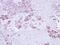 Epoxide Hydrolase 1 antibody, PA5-22020, Invitrogen Antibodies, Immunohistochemistry frozen image 