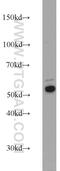 Keratin 7 antibody, 22208-1-AP, Proteintech Group, Western Blot image 