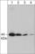 Mitogen-Activated Protein Kinase Kinase 4 antibody, MM3361, ECM Biosciences, Western Blot image 