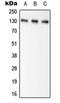 Pyruvate carboxylase, mitochondrial antibody, orb214364, Biorbyt, Western Blot image 