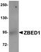 Zinc Finger BED-Type Containing 1 antibody, NBP1-76327, Novus Biologicals, Western Blot image 