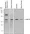 Charged Multivesicular Body Protein 2B antibody, AF7509, R&D Systems, Western Blot image 