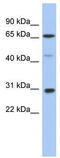 Protein Inhibitor Of Activated STAT 3 antibody, TA331151, Origene, Western Blot image 