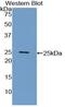 C-Reactive Protein antibody, MBS2001260, MyBioSource, Western Blot image 