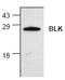 BLK Proto-Oncogene, Src Family Tyrosine Kinase antibody, AP00057PU-N, Origene, Western Blot image 