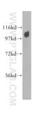 Adaptor Related Protein Complex 2 Subunit Alpha 1 antibody, 11401-1-AP, Proteintech Group, Western Blot image 