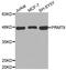 Protein Arginine Methyltransferase 8 antibody, LS-C332063, Lifespan Biosciences, Western Blot image 