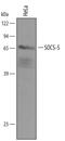 Suppressor Of Cytokine Signaling 5 antibody, PA5-48060, Invitrogen Antibodies, Western Blot image 