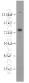 Methylmalonyl-CoA Mutase antibody, 17034-1-AP, Proteintech Group, Western Blot image 
