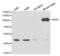 Piwi Like RNA-Mediated Gene Silencing 1 antibody, abx001762, Abbexa, Western Blot image 