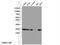 NME1 antibody, 11086-2-AP, Proteintech Group, Western Blot image 