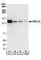 Ring Finger Protein 216 antibody, A304-111A, Bethyl Labs, Western Blot image 