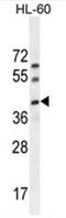 BLOC-1 Related Complex Subunit 6 antibody, AP50497PU-N, Origene, Western Blot image 