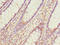 Programmed cell death protein 5 antibody, LS-C676230, Lifespan Biosciences, Immunohistochemistry paraffin image 