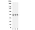C-C Motif Chemokine Receptor 9 antibody, R31235, NSJ Bioreagents, Western Blot image 