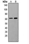 ShcA antibody, abx121735, Abbexa, Western Blot image 