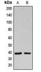 Beta-1,3-Galactosyltransferase 1 antibody, MBS820398, MyBioSource, Western Blot image 