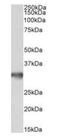 Golgi phosphoprotein 3 antibody, orb154555, Biorbyt, Western Blot image 