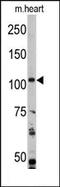 Phosphatidylinositol-4,5-Bisphosphate 3-Kinase Catalytic Subunit Alpha antibody, AP14705PU-N, Origene, Western Blot image 