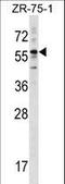 Keratin 3 antibody, LS-C165625, Lifespan Biosciences, Western Blot image 