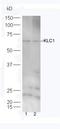 Jumonji And AT-Rich Interaction Domain Containing 2 antibody, orb157713, Biorbyt, Western Blot image 