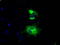 L1 Cell Adhesion Molecule antibody, LS-C114875, Lifespan Biosciences, Immunofluorescence image 