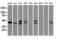 DNA Fragmentation Factor Subunit Alpha antibody, GTX84621, GeneTex, Western Blot image 