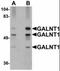 Polypeptide N-Acetylgalactosaminyltransferase 10 antibody, orb89838, Biorbyt, Western Blot image 