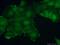 Ribosomal Protein S6 Kinase B2 antibody, 15268-1-AP, Proteintech Group, Immunofluorescence image 