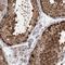COP9 Signalosome Subunit 7B antibody, HPA034676, Atlas Antibodies, Immunohistochemistry paraffin image 
