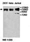 Apoptotic Chromatin Condensation Inducer 1 antibody, orb77000, Biorbyt, Western Blot image 