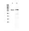 Phospholipase C Gamma 2 antibody, PA5-79827, Invitrogen Antibodies, Western Blot image 