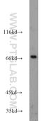 SDC antibody, 10593-1-AP, Proteintech Group, Western Blot image 